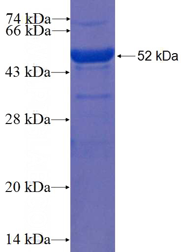 Recombinant Human PLEKHB2 SDS-PAGE