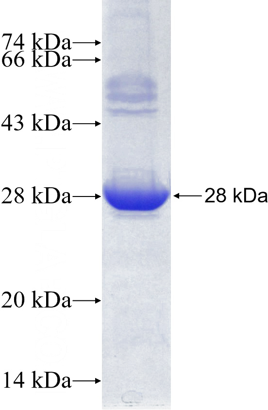 Recombinant Human GSPT1 SDS-PAGE