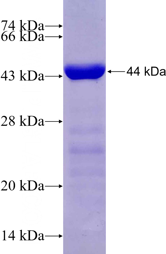 Recombinant Human JAKMIP1 SDS-PAGE