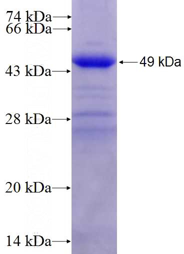 Recombinant Human NEK6 SDS-PAGE