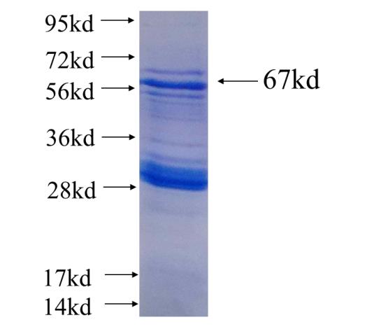 Recombinant human AMZ2(Full length) SDS-PAGE