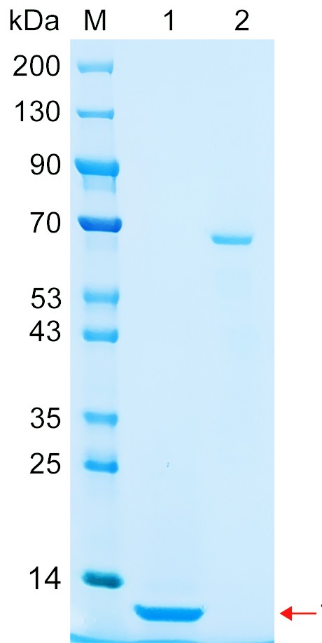Recombinant ZBT21 protein (His tag) SDS-PAGE