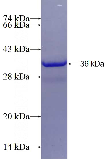 Recombinant Human EB1 SDS-PAGE