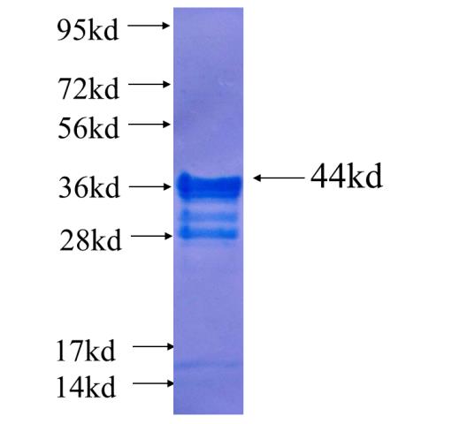 Recombinant human DDX4,VASA SDS-PAGE