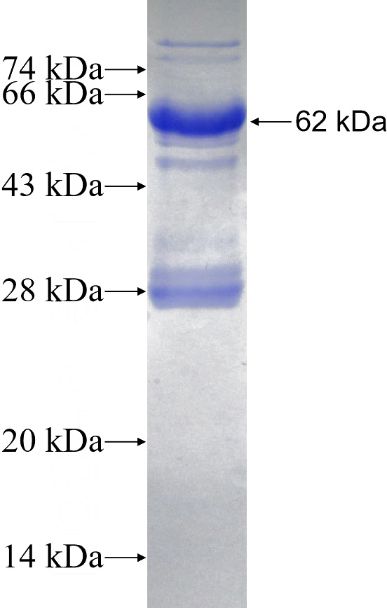 Recombinant Human PISD SDS-PAGE