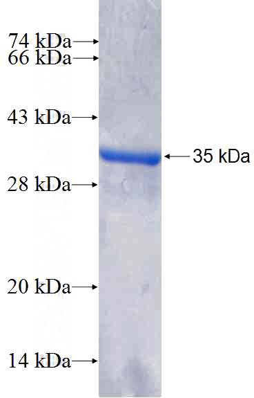 Recombinant Human EN1 SDS-PAGE