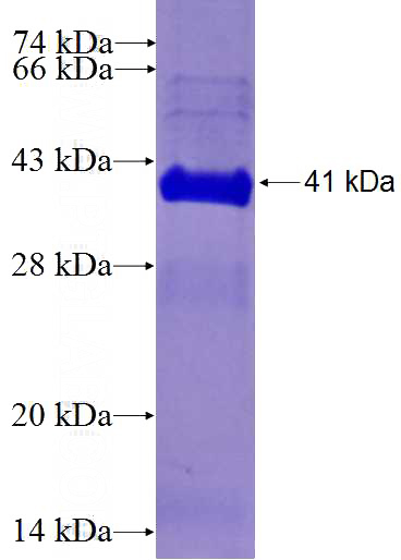 Recombinant Human EGFLAM SDS-PAGE
