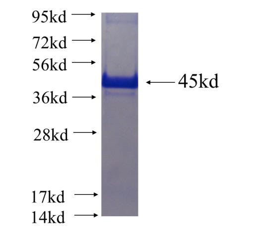 Recombinant human RNF25 SDS-PAGE