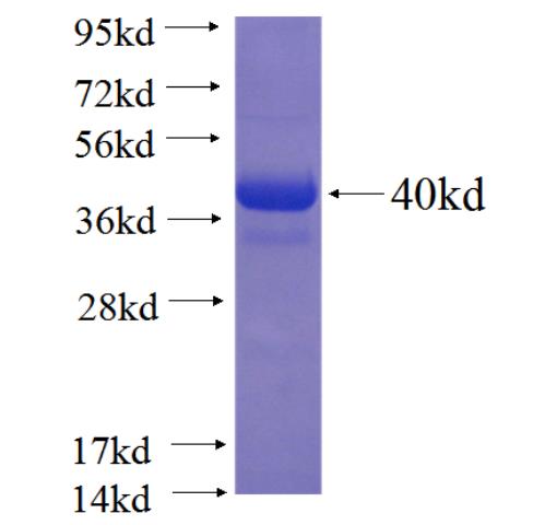 Recombinant human SIRT5 SDS-PAGE