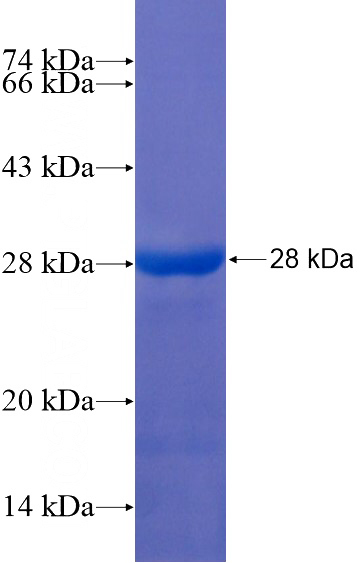 Recombinant Human MAGIX SDS-PAGE