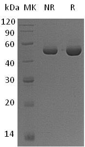 Human UBA5/UBE1DC1 (His tag) recombinant protein
