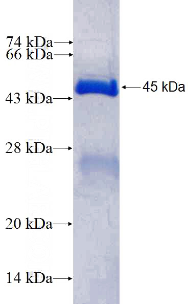 Recombinant Human DDX23 SDS-PAGE