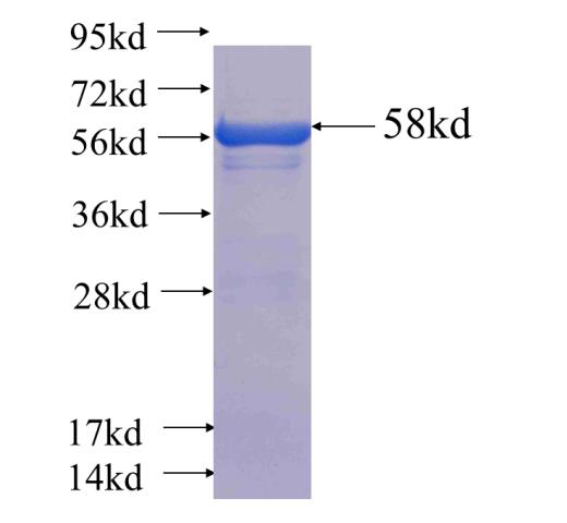 Recombinant human EXOSC7(Full length) SDS-PAGE