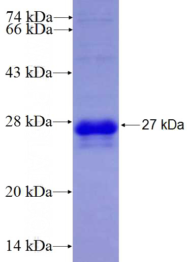 Recombinant Human RAB2A SDS-PAGE