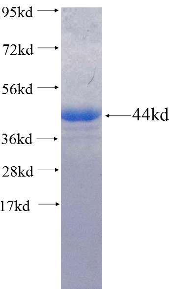 Recombinant Human CTSF SDS-PAGE