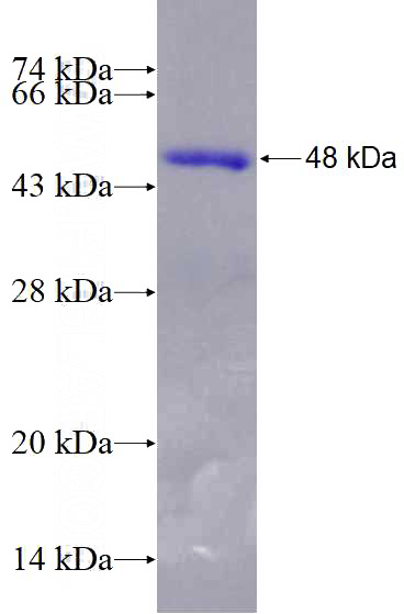 Recombinant Human SOX5 SDS-PAGE