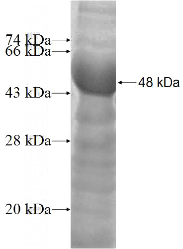 Recombinant Human SSFA2 SDS-PAGE