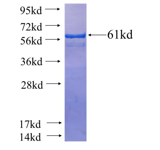 Recombinant human RASA1 SDS-PAGE