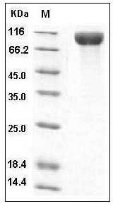Human IL13RA1 Protein (His & Fc Tag) SDS-PAGE