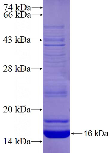Recombinant Human RAB34 SDS-PAGE