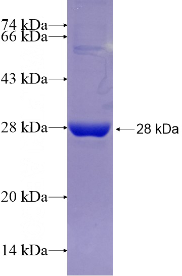 Recombinant Human ROS1 SDS-PAGE