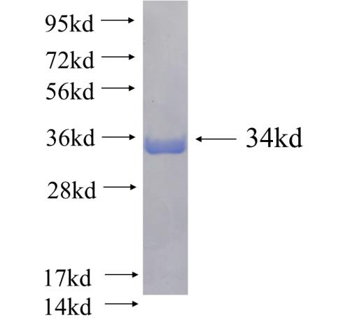 Recombinant human SNAP29(Full length) SDS-PAGE