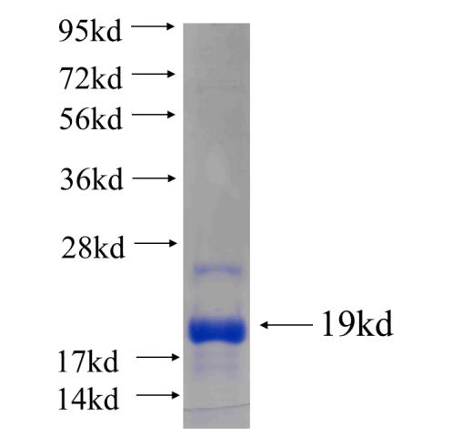 Recombinant human PUM1 SDS-PAGE