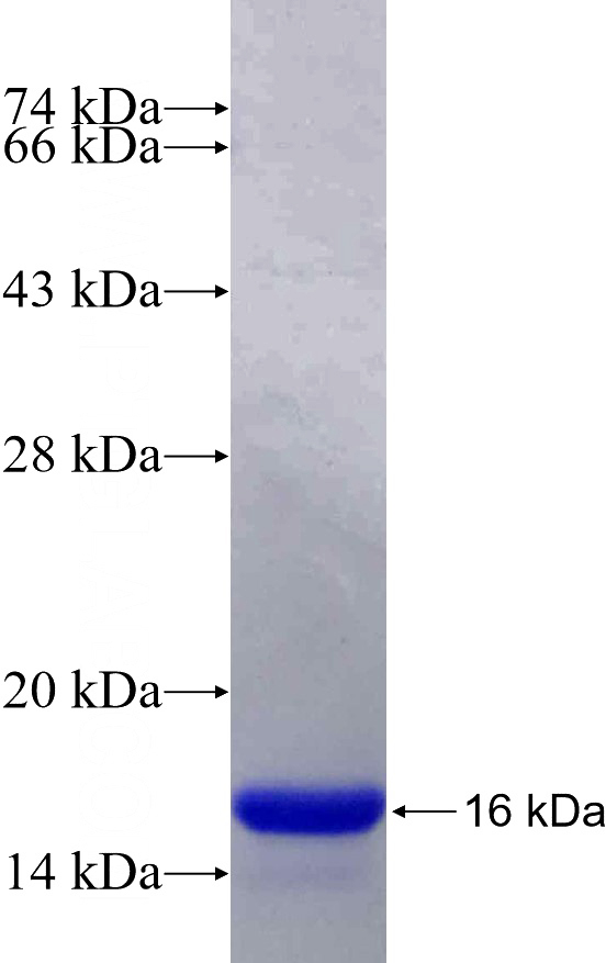 Recombinant Human SLC37A1 SDS-PAGE