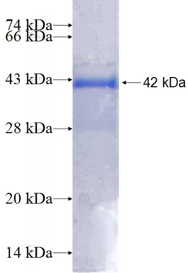Recombinant Human MICALL2 SDS-PAGE