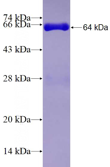 Recombinant Human NFKBIZ SDS-PAGE