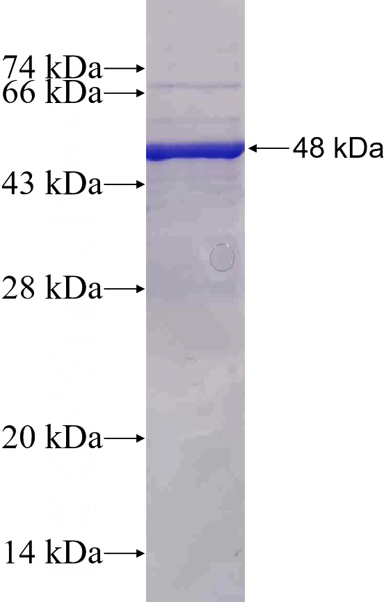 Recombinant Human ADAM8 SDS-PAGE