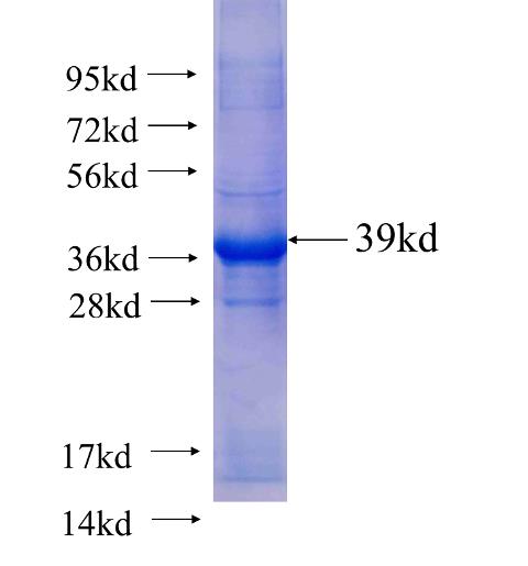 Recombinant human CAPZA1(Full length) SDS-PAGE