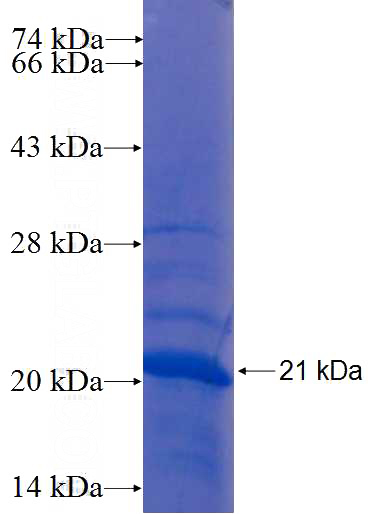 Recombinant Human ZNF645 SDS-PAGE
