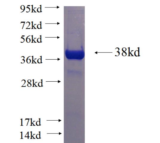 Recombinant human CENPK SDS-PAGE