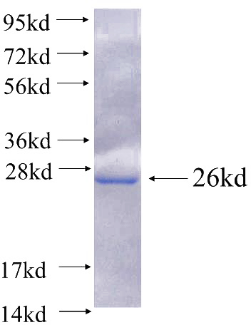 Recombinant Human ARF4 SDS-PAGE