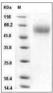 Human IL17RA / CD217 Protein (His Tag) SDS-PAGE