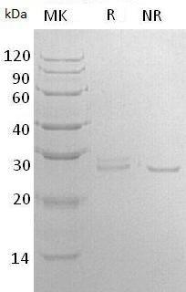 Human RPE/HUSSY-17 (His tag) recombinant protein