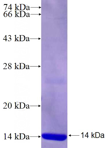 Recombinant Human RRAS SDS-PAGE