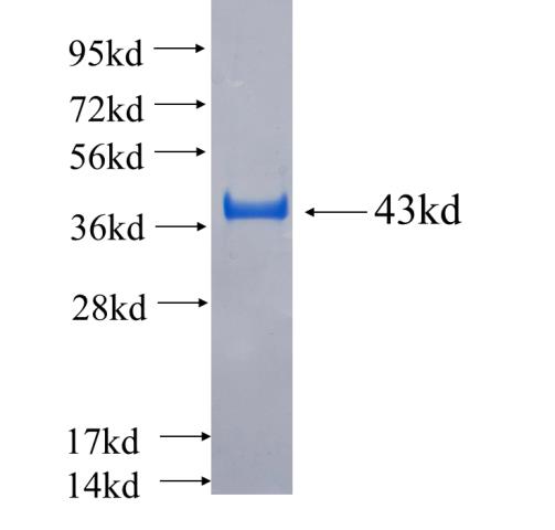 Recombinant human PLA2G6 SDS-PAGE