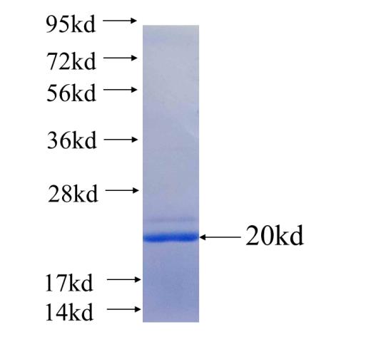 Recombinant human VPS53(Full length) SDS-PAGE