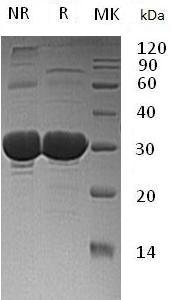 Human CLIC3 (His tag) recombinant protein