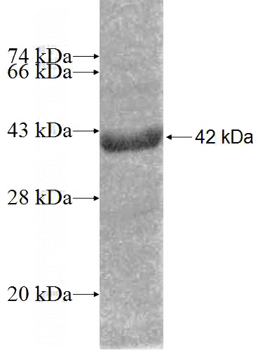 Recombinant Human BCAP29 SDS-PAGE