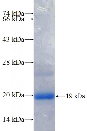 Recombinant Human VPS37C SDS-PAGE