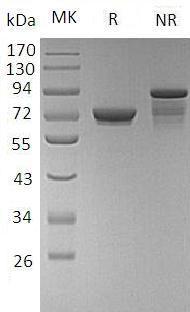Human GALNT7 (His tag) recombinant protein