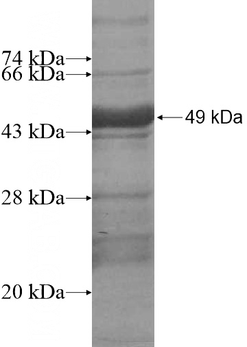 Recombinant Human GTL3 SDS-PAGE