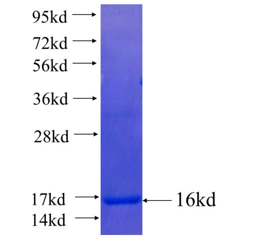 Recombinant human ACSL4 SDS-PAGE