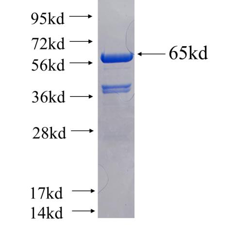 Recombinant human RRBP1 SDS-PAGE
