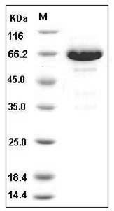 Human EphB6 / EphB6 Protein (His Tag) SDS-PAGE