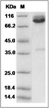 Rat Syndecan-1 / SDC1 / CD138 Protein (Fc Tag) SDS-PAGE