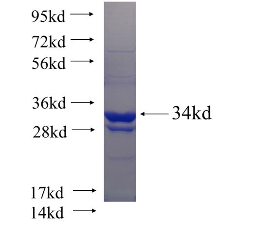 Recombinant human SLC22A6 SDS-PAGE